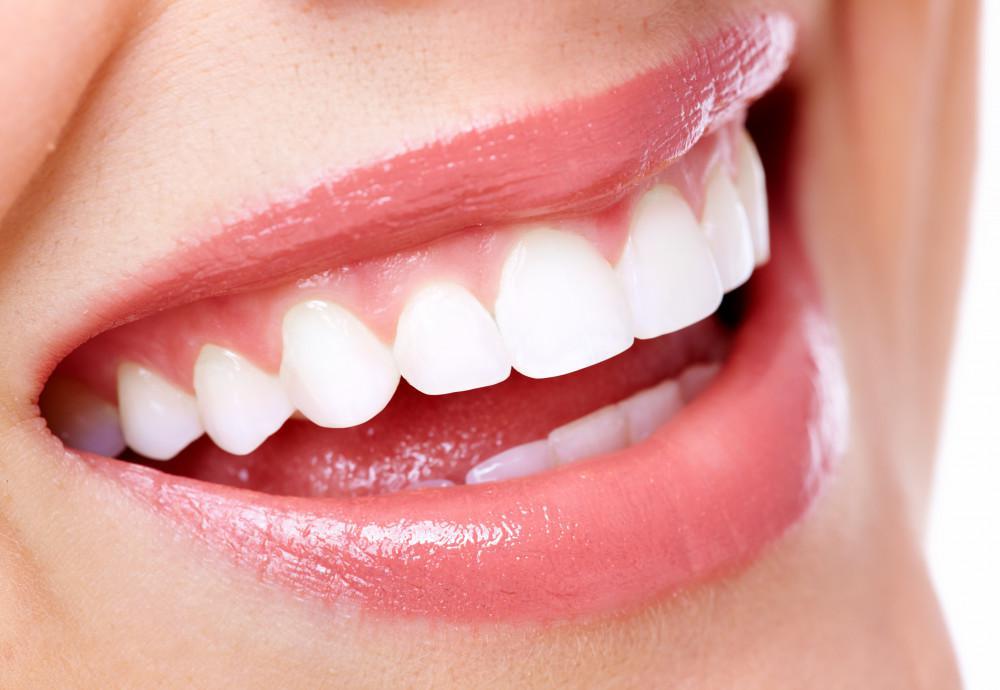 Straighten Your Teeth Without Metal Braces: Everything You Need to Know About Clear Aligners